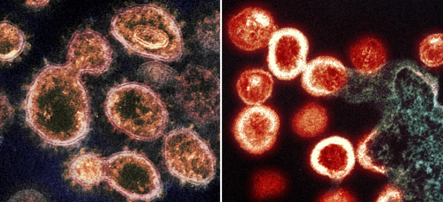 Imágenes del virus SARS-CoV-2 (izquierda) y del virus VIH (derecha). 