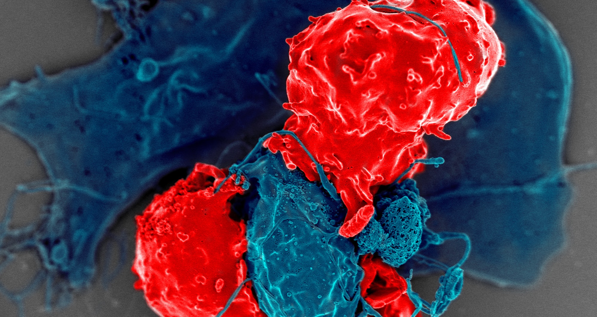 Imagen al microscopio electrónico de barrido con células T reguladoras (en rojo) interactuando con células presentadoras de antígenos (en azul). Créditos: NIAID-NIH.